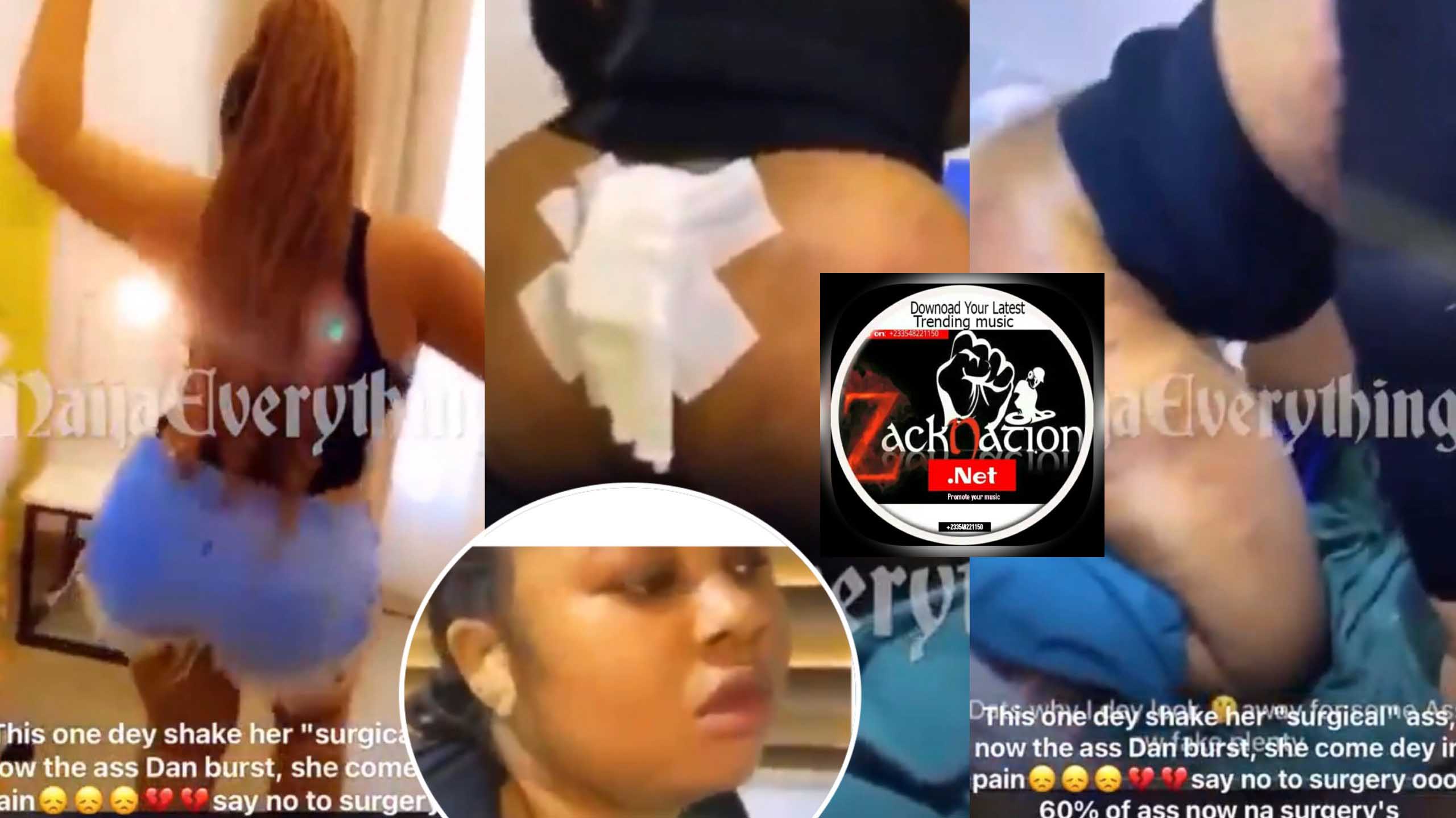 Lady Butt Surgery Went Wrong After Few Days Of Flaunting It On Social Media (Video) Lady Butt Surgery Went Wrong After Few Days Of Flaunting It On Social Media (Video)